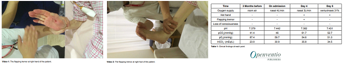 Prrmojeditor's tweet photo. #casereport Flapping Tremor as a Diagnostic Tool for
Evaluation of Hypercapnia: https://t.co/FZKiVlCDvq

Please RT!

#Flappingtremor #Hypercapnia #Hothand #Lungtransplantation #Pulmonaryrehabilitation #Lungfibrosispneumonia #Pathologicalstudies #Pulmonaryhypertensionasthma https://t.co/5cGPXyRP0M