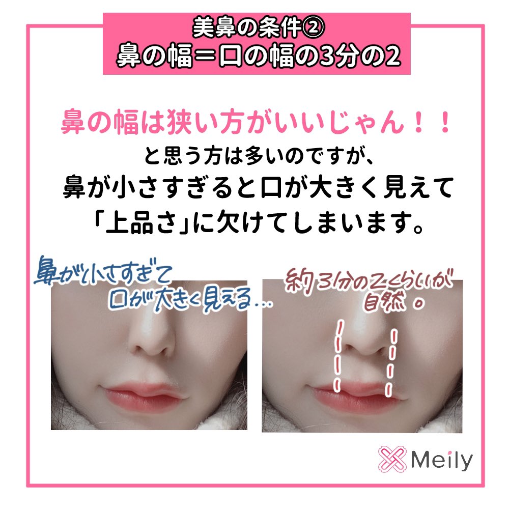 Meily メイリー 美容医療 整形snsアプリ バランスのいい鼻の条件 あの人美人だなぁ と思うお顔って顔のバランスや比率が関係してる 今日は鼻周りの比率についてまとめてみました もちろん顔立ちによってばらつきはあるので