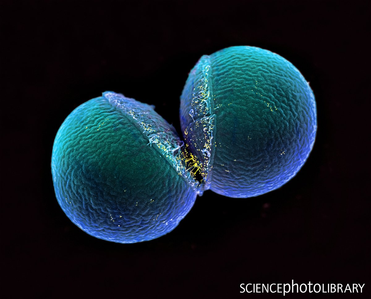 sciencephoto's tweet photo. What's your colour preference?

Coloured scanning electron micrograph (SEM) of a Monococcus sp. bacterium undergoing binary fission. 

Credit: Ikelos Gmbh / Dr. Christopher B. Jackson / Science Photo Library
https://t.co/EKEBrd5Rp9 
#bacteria #biology #coccus https://t.co/y99IhkmA7N