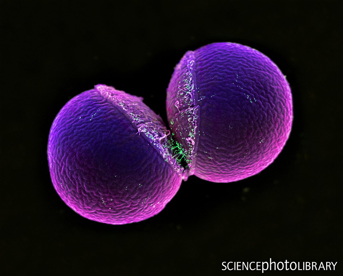 sciencephoto's tweet photo. What's your colour preference?

Coloured scanning electron micrograph (SEM) of a Monococcus sp. bacterium undergoing binary fission. 

Credit: Ikelos Gmbh / Dr. Christopher B. Jackson / Science Photo Library
https://t.co/EKEBrd5Rp9 
#bacteria #biology #coccus https://t.co/y99IhkmA7N