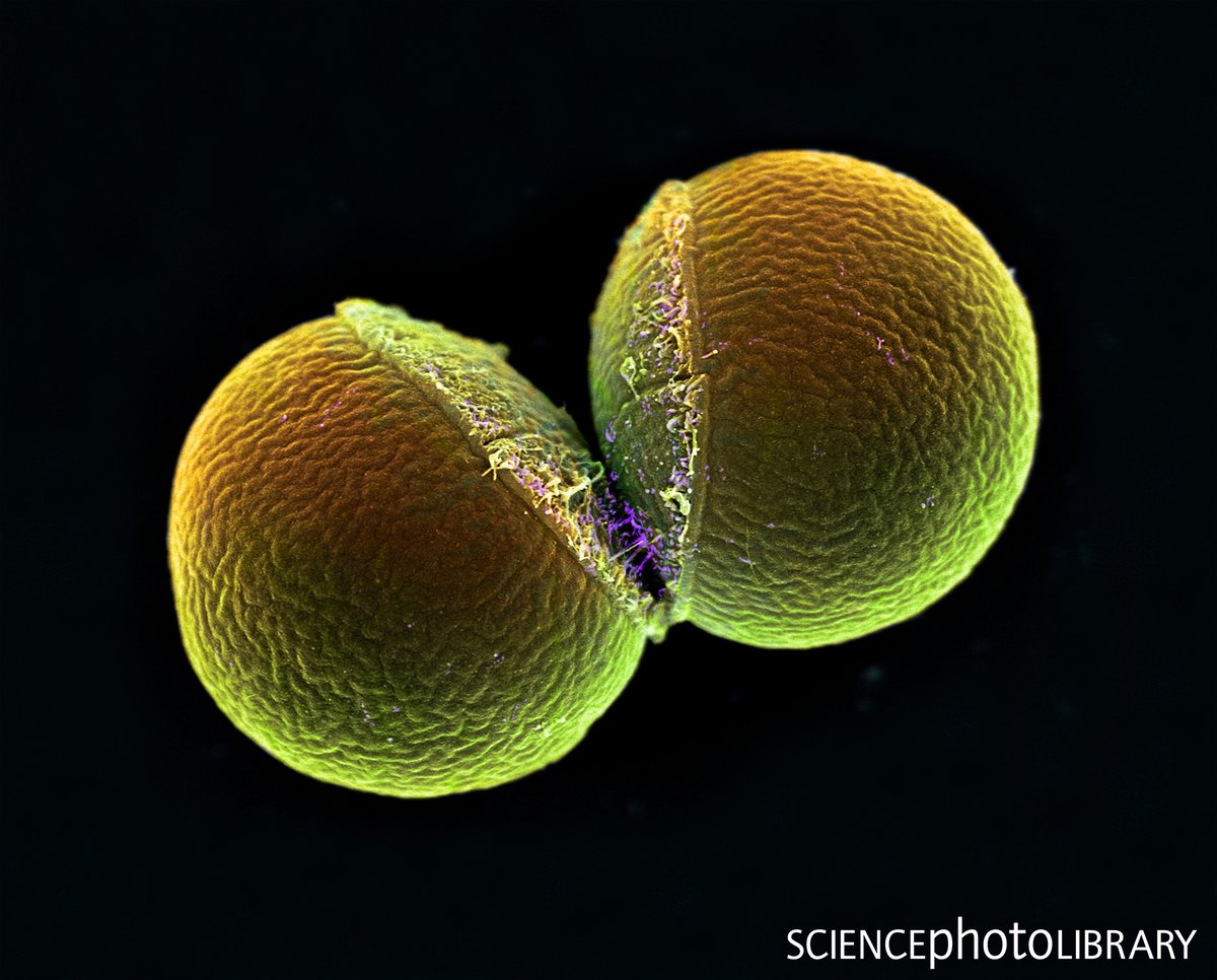 sciencephoto's tweet photo. What's your colour preference?

Coloured scanning electron micrograph (SEM) of a Monococcus sp. bacterium undergoing binary fission. 

Credit: Ikelos Gmbh / Dr. Christopher B. Jackson / Science Photo Library
https://t.co/EKEBrd5Rp9 
#bacteria #biology #coccus https://t.co/y99IhkmA7N