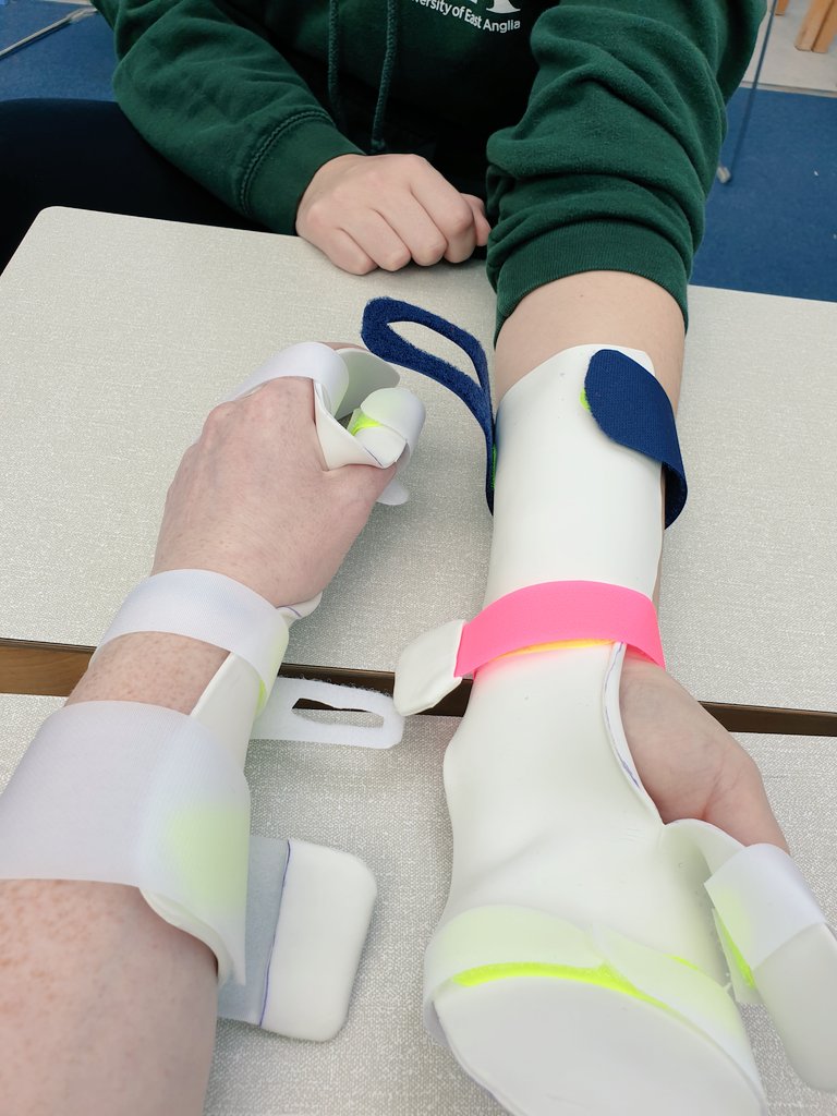 Nat_OT_student's tweet photo. More splinting today!! @pip_otstudent @OT_UEA @UEAOTSoc @UEA_Health #OccupationalTherapy #occupationaltherapystudent https://t.co/V7ppAT5EaE