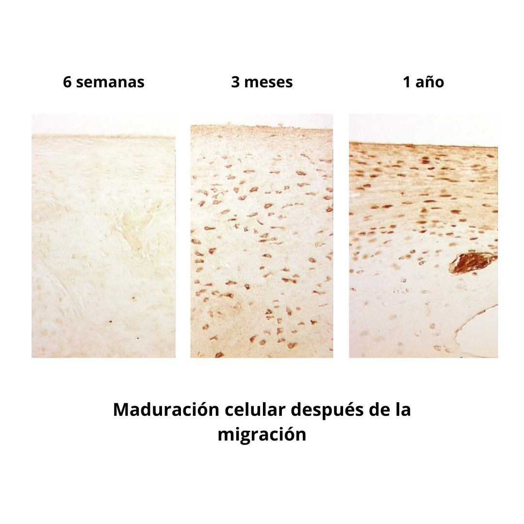 viscobasic's tweet photo. Gracias a Chondrofiller® se abre una nueva etapa para el tratamiento rentable, eficaz y eficiente de las lesiones de cartílago articular en comparación con el trasplante de condrocitos autólogos en dos etapas (ACT). https://t.co/VMZ9ODmRgl