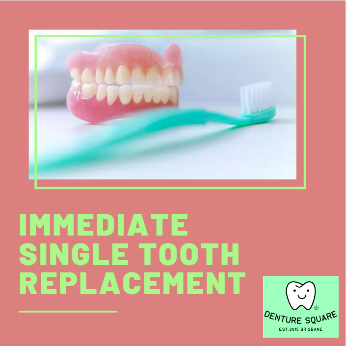 denturesquare's tweet photo. @denturesquare look forward to fulfill your #missingteeth or #teethgaps without replacing the plate by Immediate #ToothReplacement. 
#dentist #dentistry #smile #teeth #dentalcare #dentalogy #dentalclinic #dentalhygienist https://t.co/nrCrwRW6SS