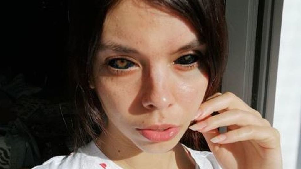 vissumESP's tweet photo. Advertencia. Una modelo se queda ciega tras tatuarse los ojos.  https://t.co/mw8E105Ajt by @informativost5 https://t.co/zakcvz0Kje