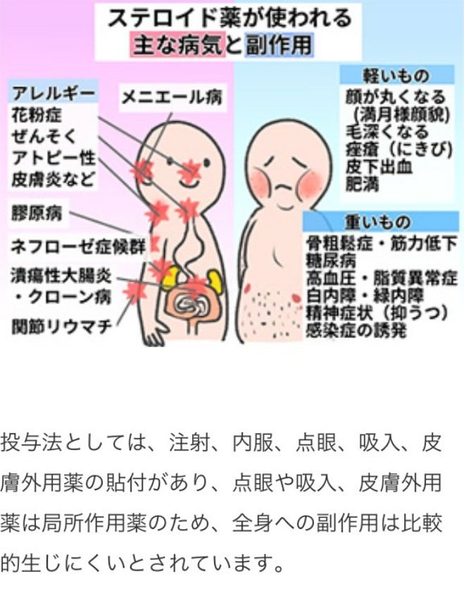 Uzivatel Marvel 11 エロアカ即ブロックします Na Twitteru ２月から ステロイド減薬少しずつですがはじめました 花粉症と アレルギーと 温度差による喘息発作でなかなかうまくいきません ステロイド副作用白内障以外全て当てはまる 骨密度もヤバい 太っ