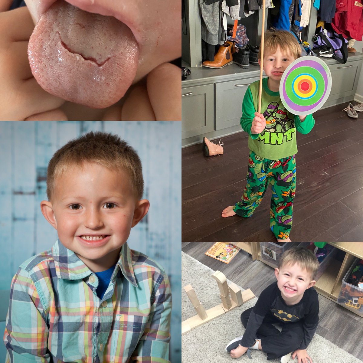 IggNoard's tweet photo. This boy is 4 today, to put it nicely he is ornery as all get out and tests our patience daily. We didn’t get to see him much yesterday so he made up for it by biting through his tongue instead of going to bed. Happy Birthday #KinnikThad https://t.co/3dMUg6yBbG