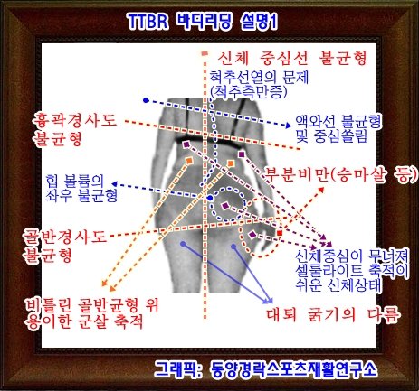 hurbworker's tweet photo. #휘어진골반 문제 방치할 경우 하체에 #통증 이나 #마비감 생기거나 #부종 과 #냉증 을 일으키게 됩니다. 하체에 #군살 #셀룰라이트 가 #집중 됌. 

#요통 #요요현상 #골반염 #골반통증 #다리저림 #하지부종 #좌골 #신경통 #골반교정 #하체비만원인 
https://t.co/7gufxMYQ6B
,
#찐 #티티브라 #TTBR https://t.co/vGlNoyphFf