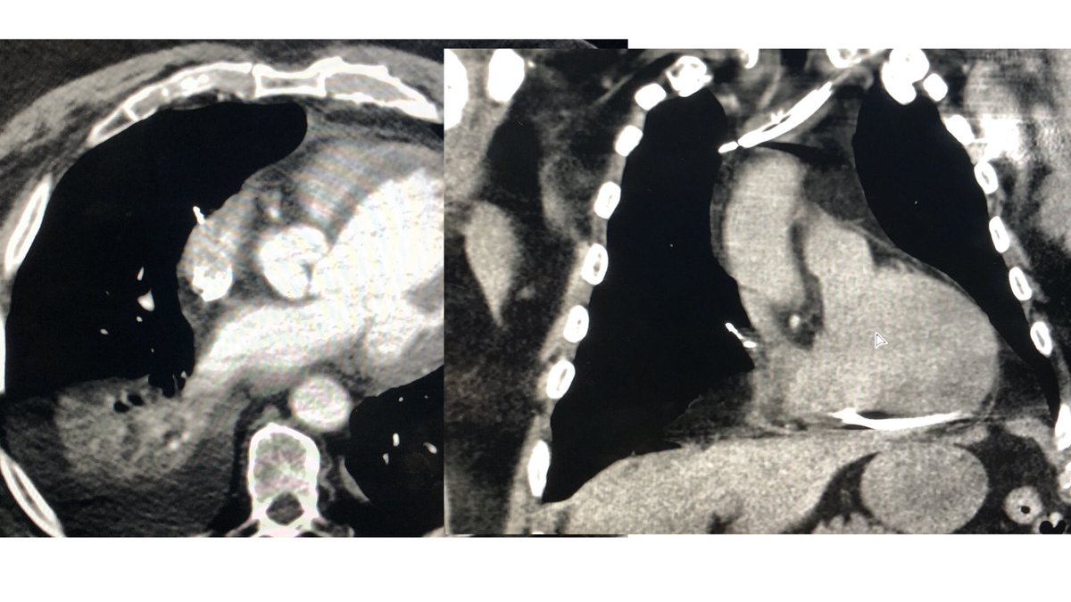 Roger Carrillo, MD tweet media