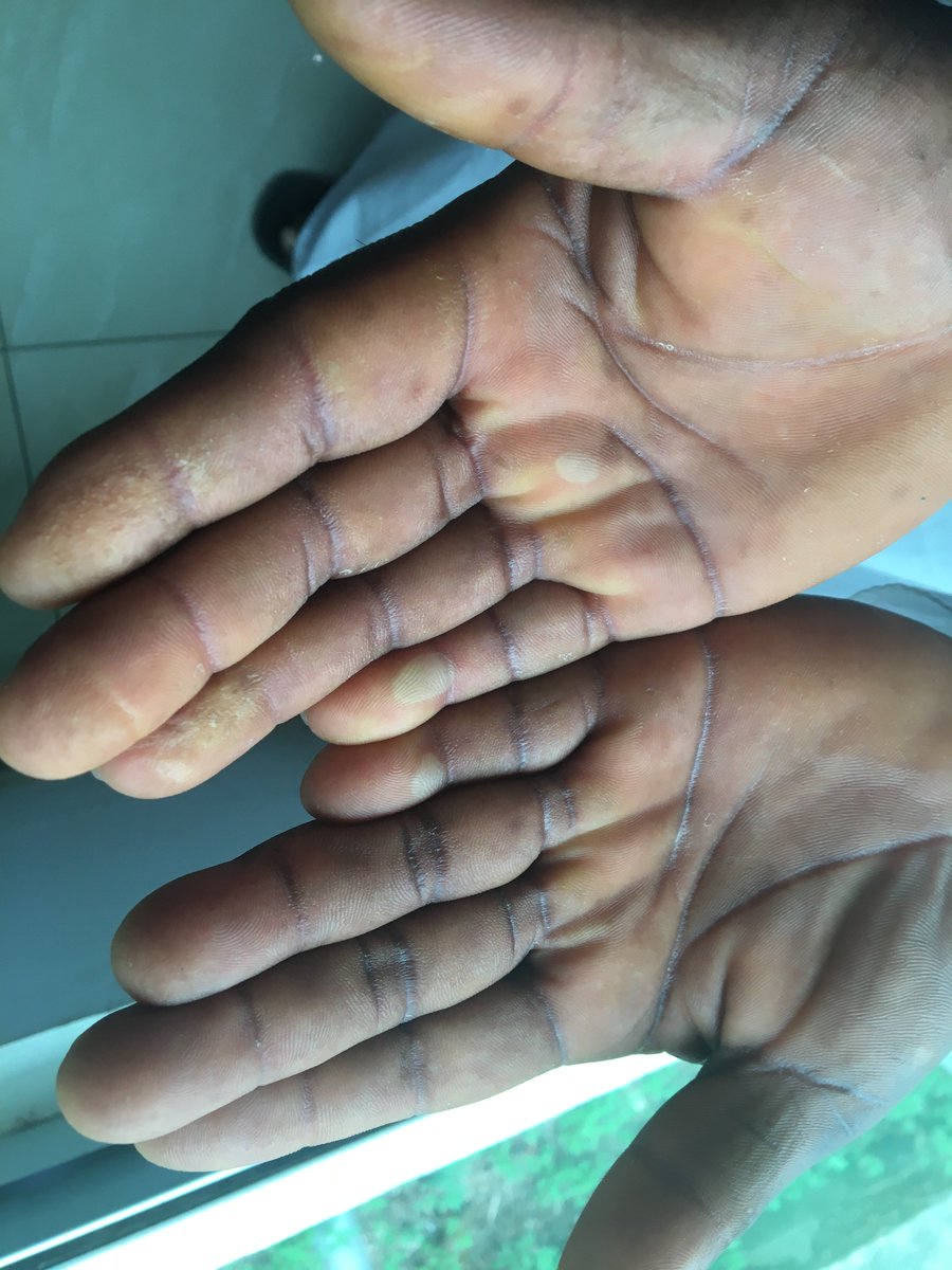 LA_Bagnetto's tweet photo. The military "killed my elder brother, then my second brother, then they killed my uncle," says Pierre, 38, speaking of #Cameroon #Anglophonecrisis. He worries he'll be next. This fear haunts many young #Anglophone men SW Cameroon #Cameroons 
https://t.co/4y4H8KoQdl https://t.co/UmlfY0lENZ