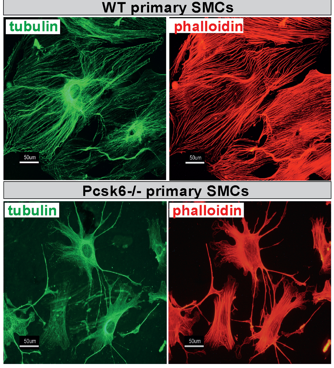 CircRes's tweet photo. PCSK6 is a key regulator of #SMC function in vascular remodeling.

Mechanistically, #PCSK6 achieves its function via modulation of #contractile markers and #MMP14 activation (link). @karolinskainst  @MMK_research 
https://t.co/sFXe5jlWpp https://t.co/35Z5nI7NcK