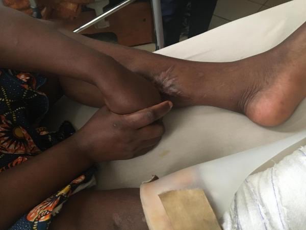 loucharbon's tweet photo. .@LA_Bagnetto’s harrowing report on suffering of civilians in #Cameroon’s anglophone regions, caught in crossfire of fighting between govt forces &amp; anglophone separatists. Cites research by my @hrw colleague @ilariallegro https://t.co/Oxl6vbHsXU https://t.co/cSgZI9pfNj