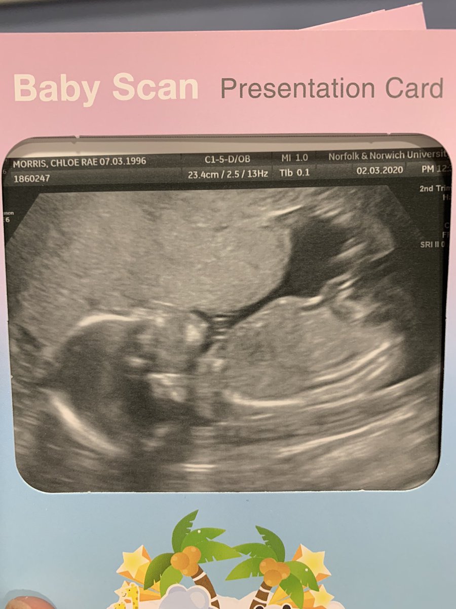 We’re team pink again! Can’t wait to welcome another little girlie to the family 💗💗