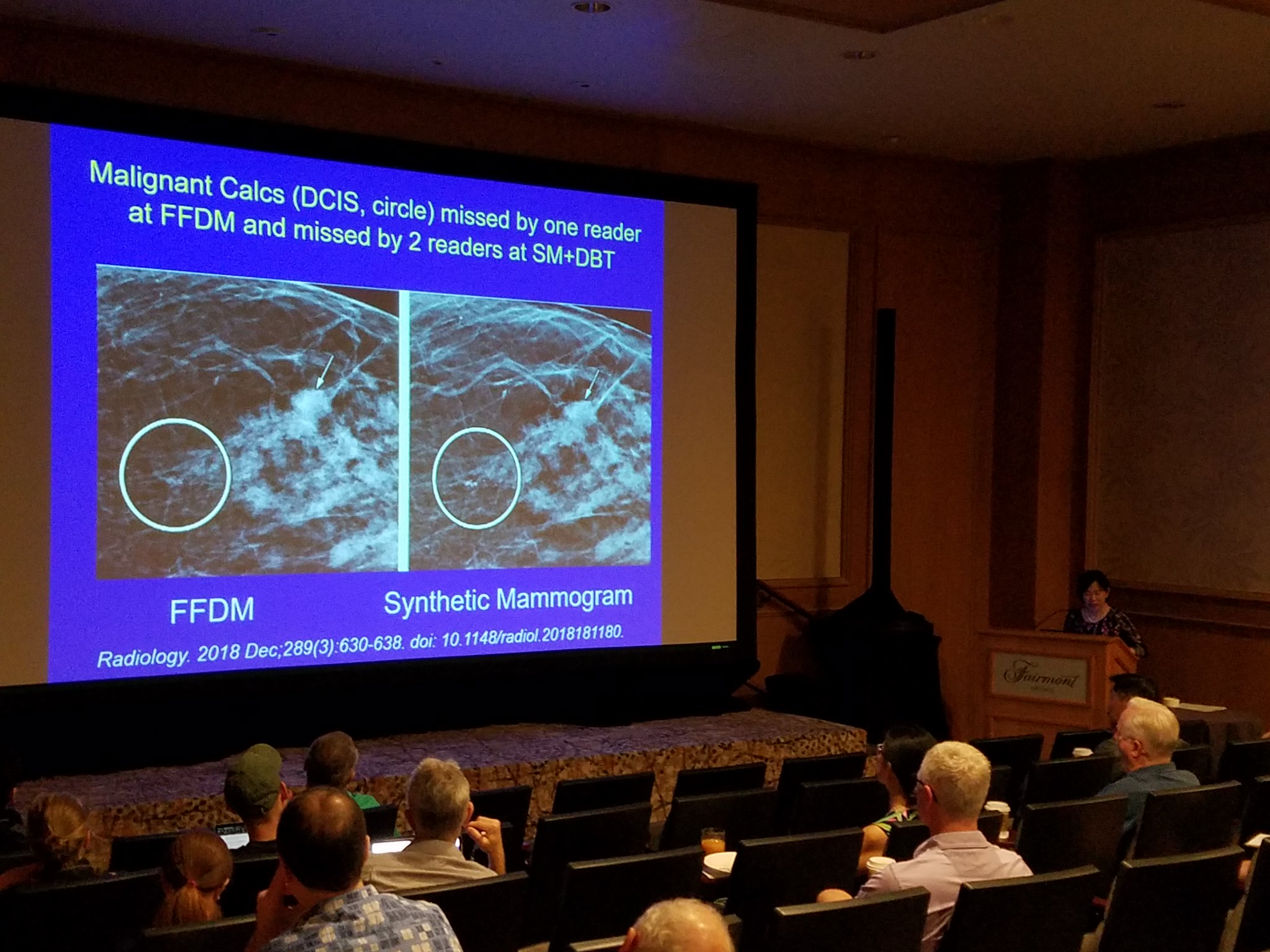 UCSF Radiology CME on Twitter "Breast Imaging Day 2 Dr Bonnie Joe / Tomosynthesis; Dr. Amie