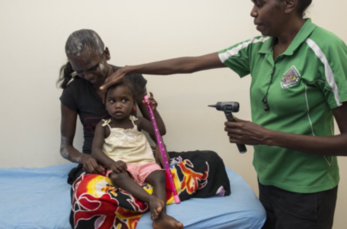 On #worldhearingday2020 a plea to health staff seeing Aboriginal &amp; Torres Strait children:

ALWAYS👏🏽CHECK👏🏽EARS👏🏽

Glue ear is rising. It’s silent. It causes hearing loss. It starts before bub is 6-12 mths &amp; lasts for years - unless you notice it.

1 in 3 bubs have it.
