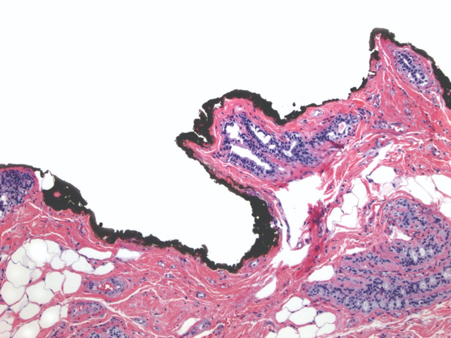 VectorSurgical's tweet image. Join our @VectorSurgical team February 29-March 5th at #USCAP20 for a live #MarginMarker demonstration. Surgeons are adopting our inks as the Global Standard for tissue orientation. Find out why at exhibit #821.