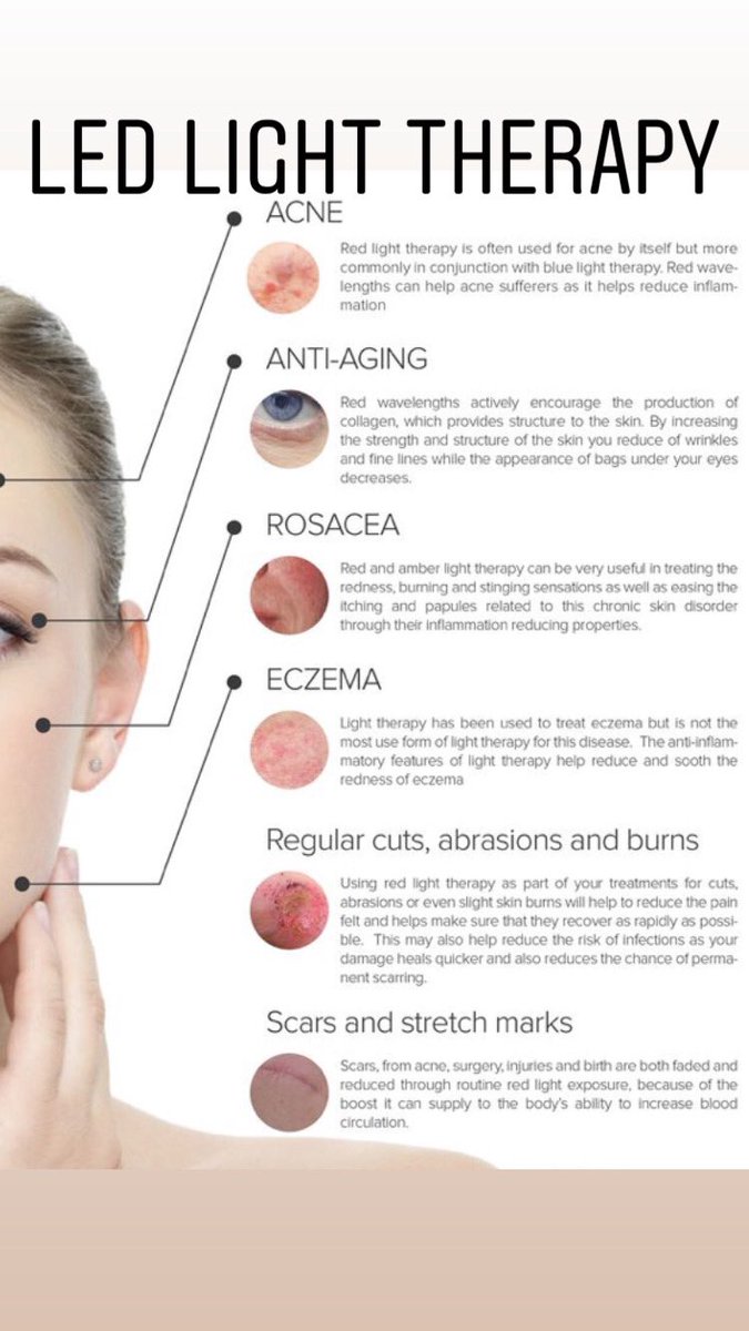 Neutrogena Light Therapy For Rosacea / Red Light Therapy For Rosacea Lasers Led And Beyond