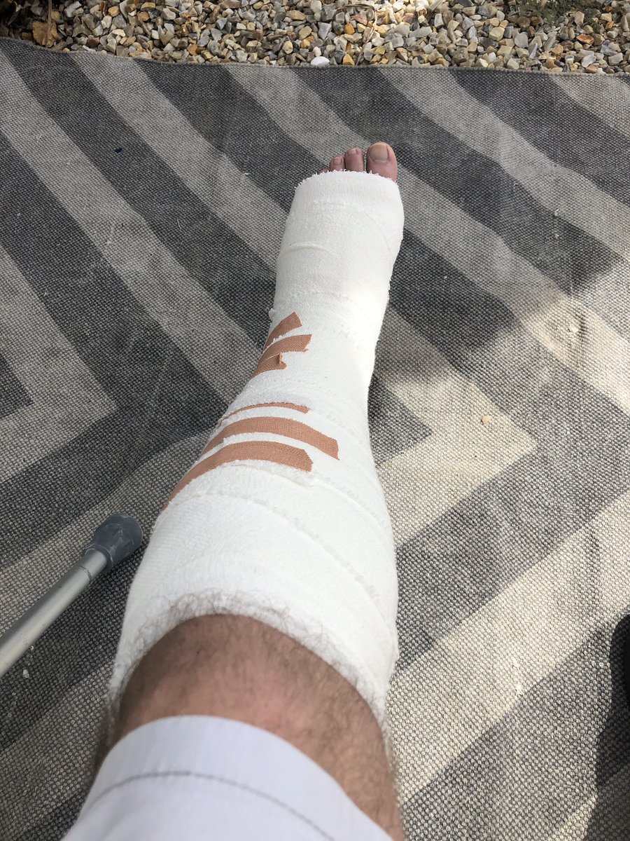 Ruptured achilles. Fun times ahead!!