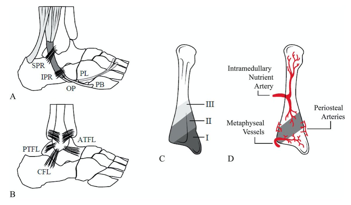 Evaluation and Management of Lateral Ankle Pain Following Injury

ow.ly/a8hh50yuFYa