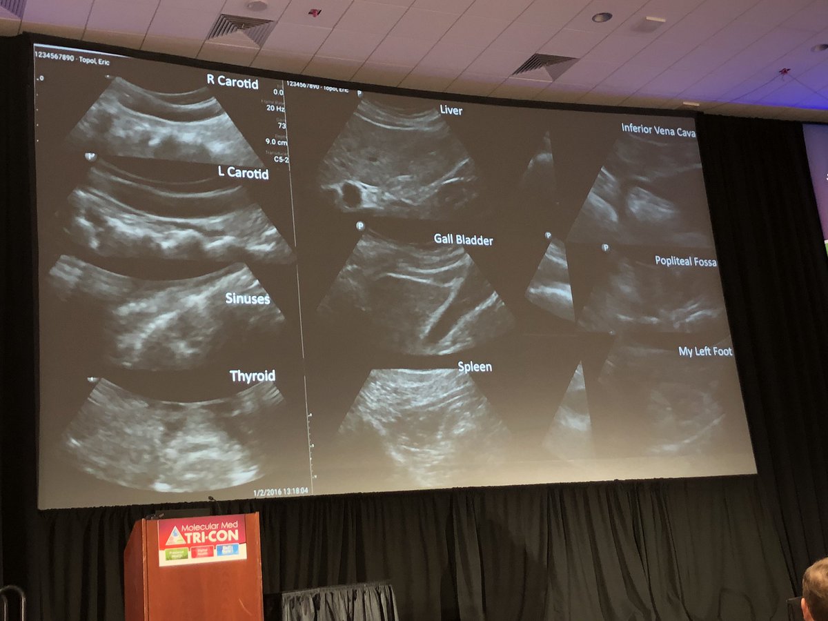 Ultrasound examination becomes extremely accessible. <a href="/EricTopol/">Eric Topol</a> shares his ‘medical selfies’. Ultrasound with a smartphone. #TRICON