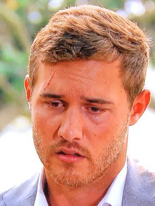 This looks like one of those comparisons of a President at the beginning vs the end of their term LMAO #thebachelor