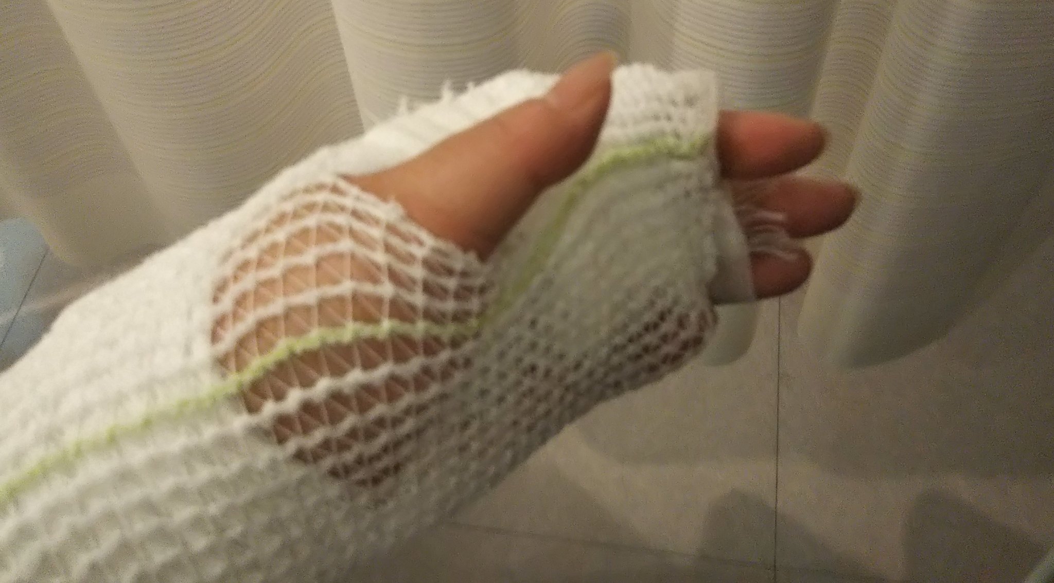 Hare時々座敷童 Ixion 怪我した直後 私 ギブス固定しなくちゃ駄目 医者 もう靭帯断裂してるから 今から固定しても 意味ないね はっはっは 私 よっしゃ 中指動かさなければ消化いけるな 手術後 医者 しばらくギブス外さないでね 私 手術前より