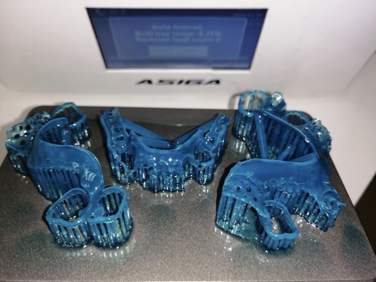 1dentallab's tweet photo. Printing to the Max @Design2Smile #Asiga #AsigaUVMax #3Shape #KeySplintSoft #DigitalDentistry #Awesomeresults https://t.co/Cr6NYfQAhh