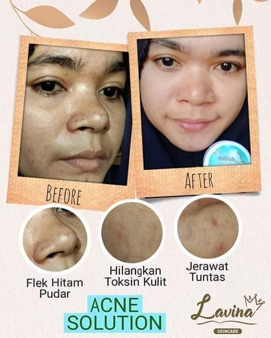 manfaat lavina skincare