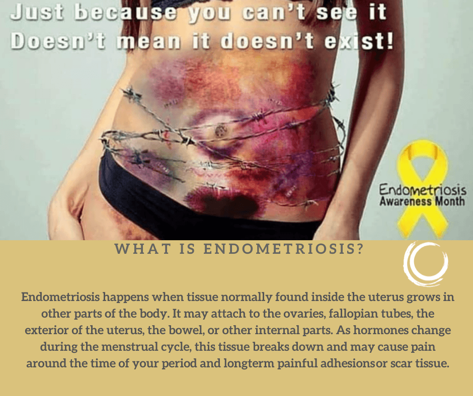 pauladuffin's tweet photo. What is #endometriosis? Let's Get Educated ladies! 
#EndometriosisAwarenessMonth #acupuncture #womenshealth #healthyWexford #WexfordWellness #PainFreeWexford #InfertilityWexford https://t.co/tK1mL9uCB6