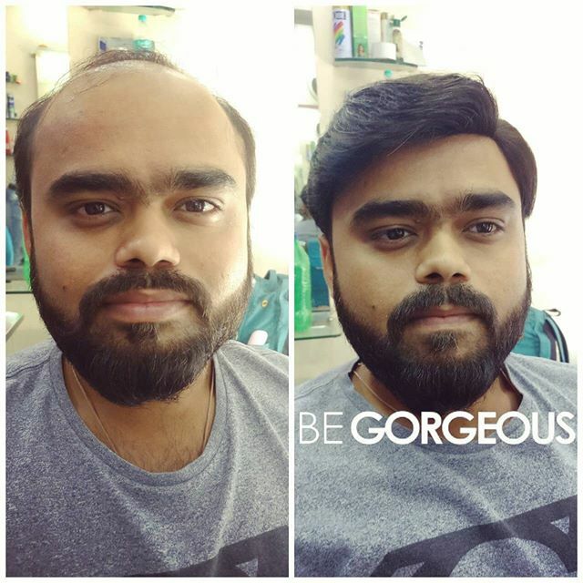 begorgeousfunke's tweet image. BE GORGEOUS WIGS AND PATCHES 😍
#begorgeous #begorgeouspro #begorgeousmen #beforeandafter #wig #patch #frontal #closure ift.tt/38fydmb
