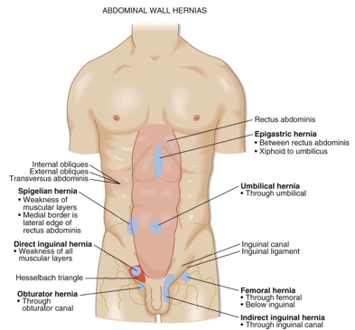 SciResLiteratur's tweet photo. International Journal of #Case_Reports &amp; Short Reviews.
#Laparoscopic Approach to Intestinal Occlusion Due to Incarcerated #Femoral_Hernia with an Unusual Postoperative Management.
https://t.co/tcUAKzDIhc
#nashvilletornado https://t.co/LybasRh7od