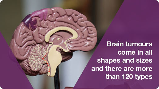 ClarkeWillmott's tweet image. Every affected individual will experience unique symptoms based on the location, stage and type of brain tumour. Diagnosis can be challenging. @mmt1_marguarita outlines the main types of #braincancer and what they include bit.ly/2Ifc2SK

#LetsTalkSupport #braintumour