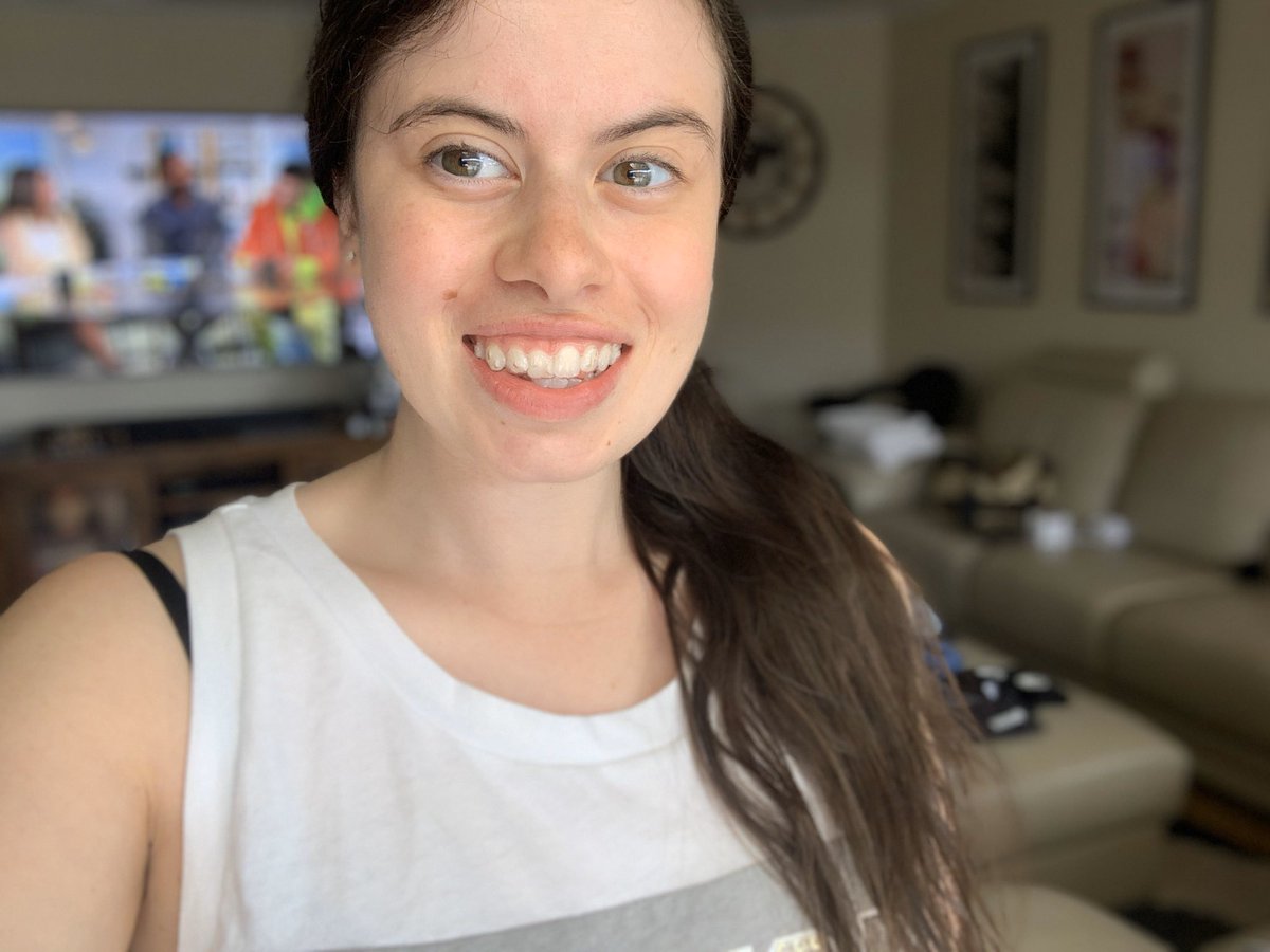 TashSheppard22's tweet photo. So today was my first day with my Invisalign✨💎 @invisalign #invisalign #teeeth https://t.co/dlEnbFI4v5
