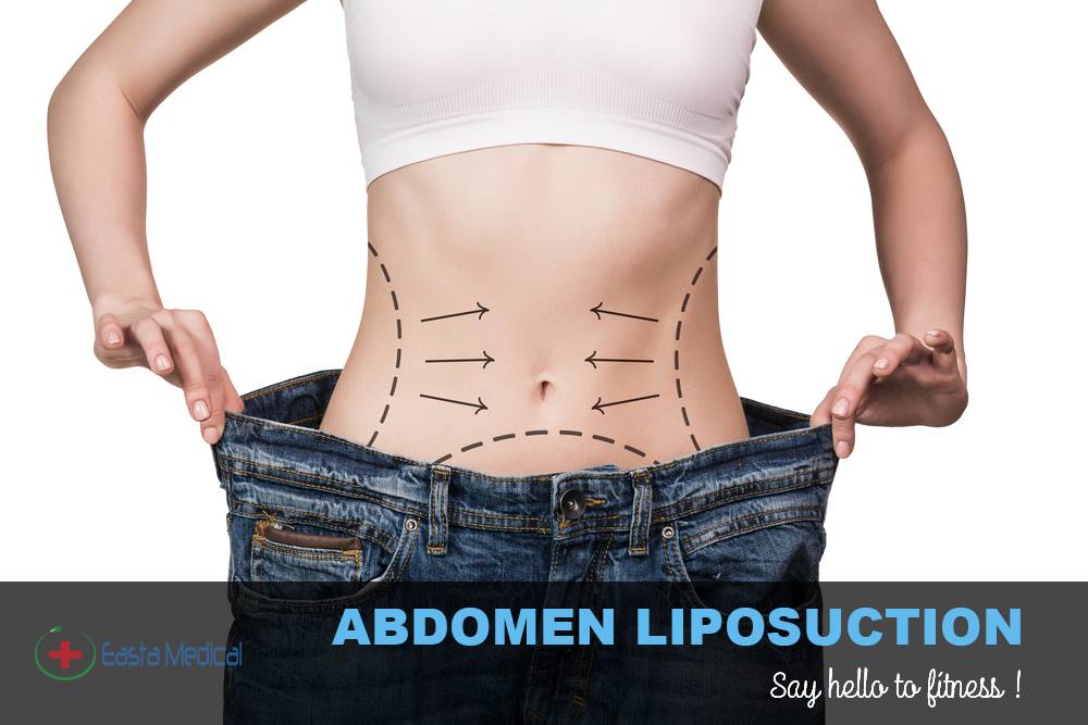 eastamedical1's tweet photo. We follow many diet charts to get ride from a fat tummy but result never satisfied us. But #Abdomen_liposuction will help you to overcome from that and you will get the most desired curvy shape of your figure.
Detail information: https://t.co/v3IdzsGfz5 https://t.co/sM6YpnhkTE