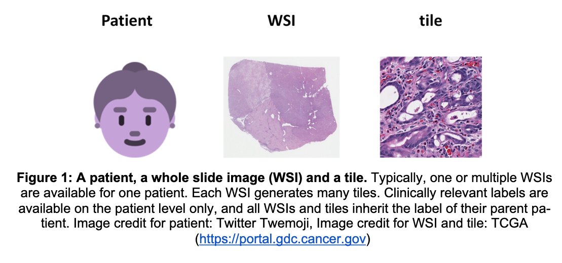 jnkath's tweet image. We have published our hands-on guide for data preprocessing in #DeepLearning #histology on @ZENODO_ORG at zenodo.org/record/3694994 We use this for projects that involve prediction of high-level labels (cancer type 🦀, mutation 🧬, outcome 📈) from histology. Feedback is welcome!