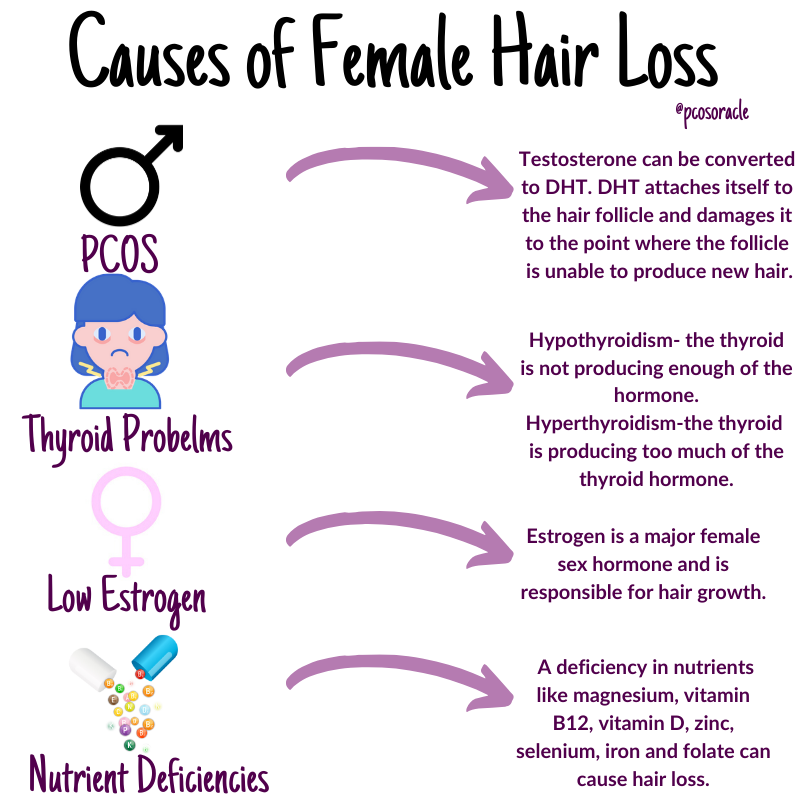 Hair Loss  Womens International Pharmacy