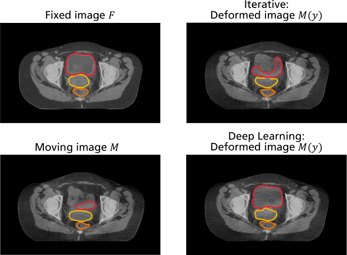 FraunhoferMEVIS's tweet photo. Improved registration of #ConeBeamCT images using #DeepLearning: Find out more in our poster at @BVM_workshop 2020 in #Berlin. https://t.co/L616creC1a #ImageRegistration #BVM2020 https://t.co/tQG6lJSdua