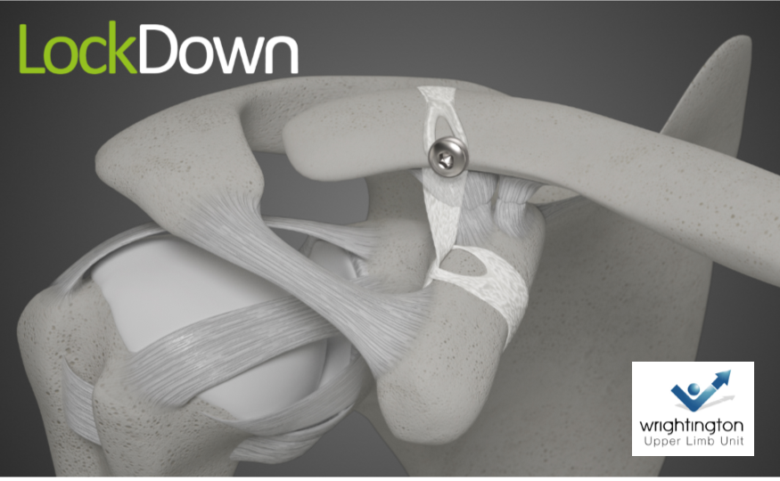 Lockdown Medical Ltd tweet media