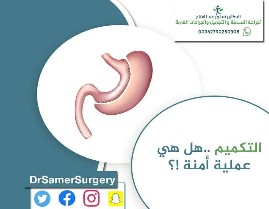 #التكميم_جراحة_آمنة!
تجري هذه #العملية #تحت_التخدير_العام،وهذا يعني أن المريض سوف يكون في حالة #نوم_عميق ولن يشعر بأي #ألم. يمكن إجراء العملية عبر #شق_جراحي كبير في #البطن أو بواسطة #المنظار عبر بضعة #جروح صغيرة في #البطن، حيث تسمى في هذه الحالة الجراحة #بالمنظار أو جراحة تنظيرية