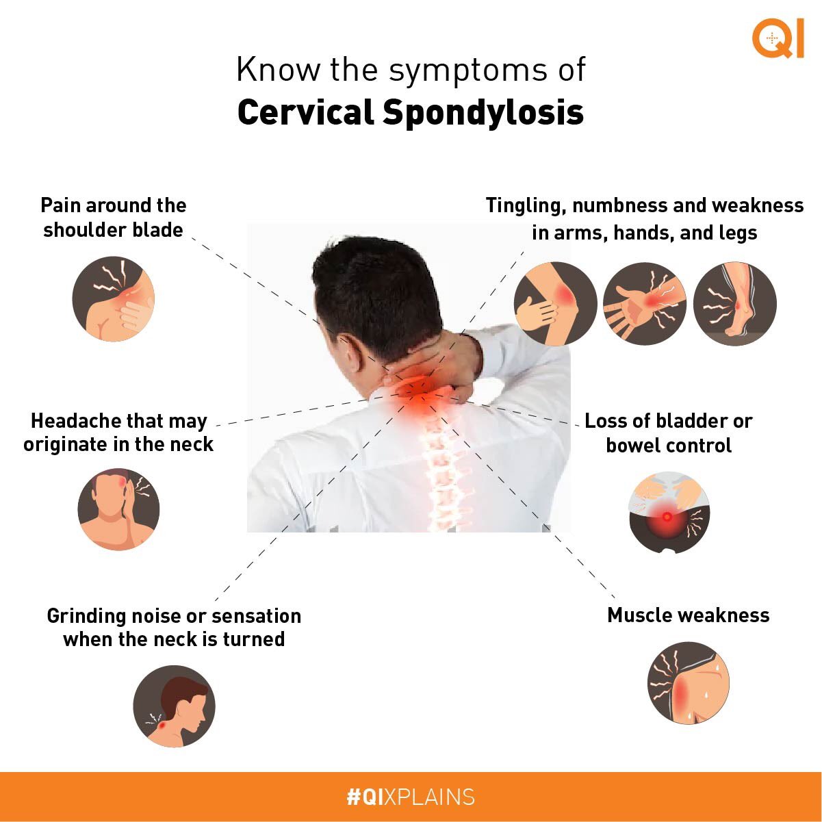 Cervical Spondylosis Causes Cervical Spondylosis Causes