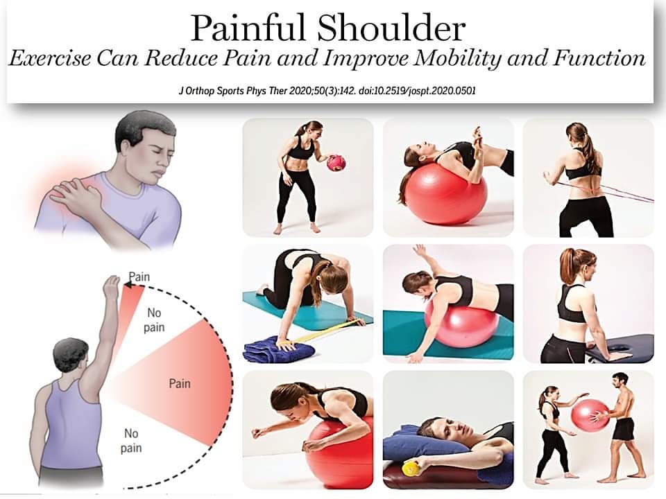 felipeisidro13's tweet image. La terapia con EJERCICIOS es el principal tratamiento para mejorar el dolor, la movilidad y la función en personas con HOMBRO DOLOROSO
pubmed.ncbi.nlm.nih.gov/31726927

Excelente libro de ejercicios por niveles para hombro doloroso:
shoulderdoc.co.uk/documents/Shou…

#ExerciseWorks 😉
