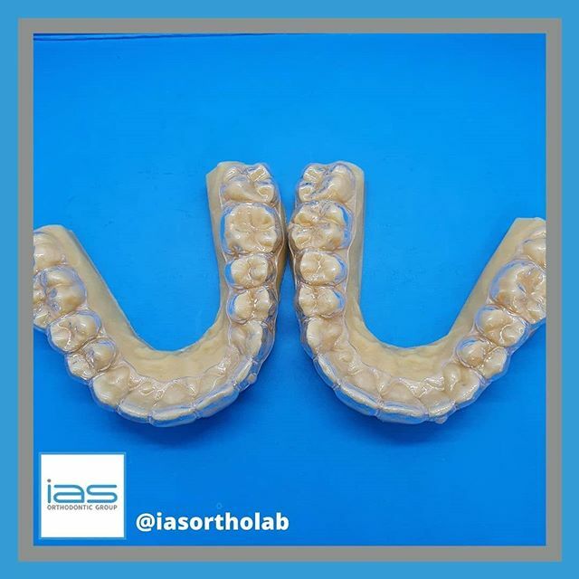 Refiners are a fantastic way to get that last little bit of movement post treatment! 
#refiner #aligner #ias #smile #orthodontic #dentistry #dentaltechnician #dentalphotography #teeth #ortho ift.tt/3ancf2g