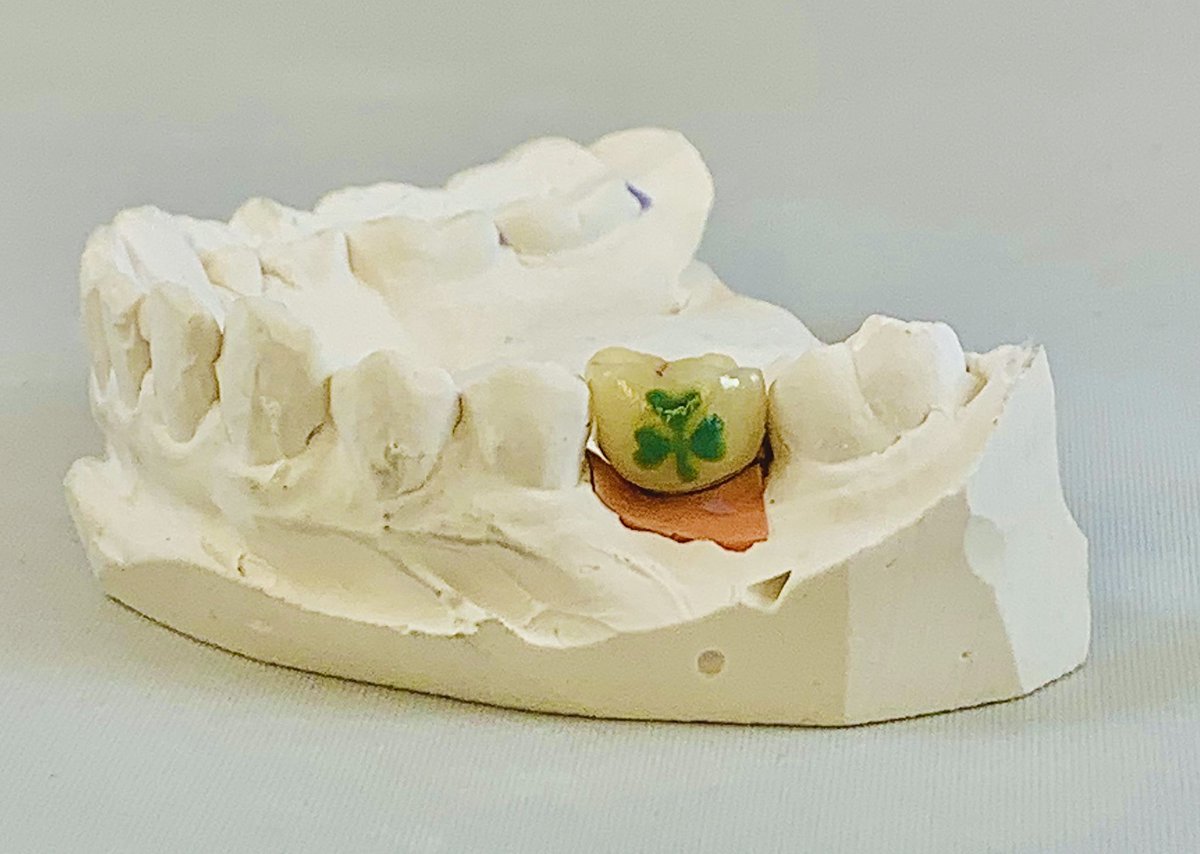 GenCordswainer's tweet photo. Made this tooth just in time for St. Patrick’s Day. #happystpatricksday #toothtattoo https://t.co/PFxkxdyttu