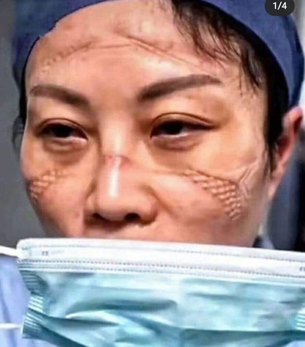 WPedro's tweet photo. No Nerdcast 712 sobre o Covid-19, o @oatila menciona que as máscaras de proteção da equipe médica tem de ser tão apertadas a ponto de que sua respiração tem de ser puramente através da máscara. E isso é oq acontece :| #CoronaOutbreak https://t.co/YRazdpX3UO