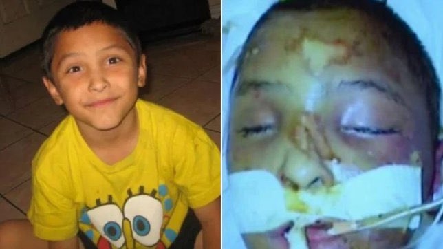 Hannaaaaah He Was Also Gagged To Make Him Quiet His Mom Made Him Shave His Head To Burn His On His Skull Here Are Some Pics He Wanted To Take