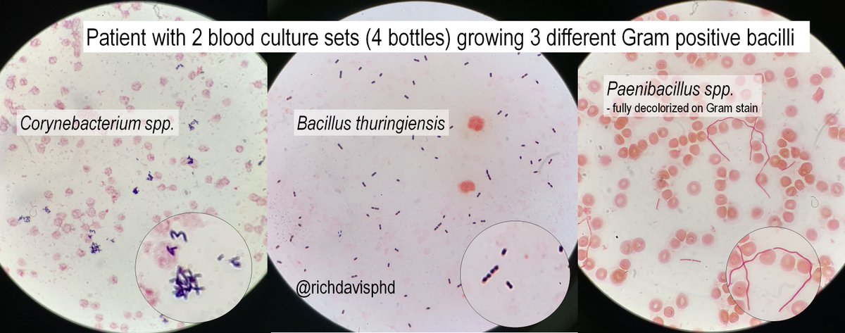 Gram Positive Rods In Blood Culture