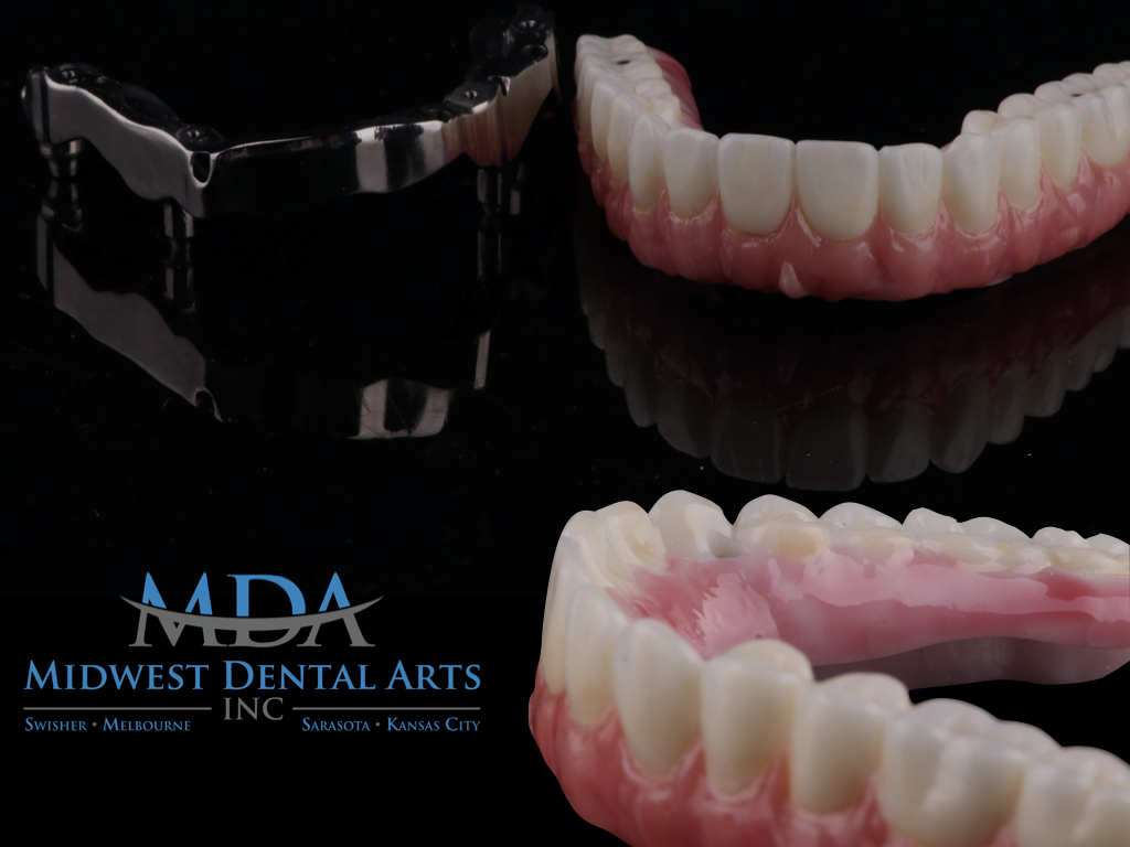 midwest dental arts melbourne fl