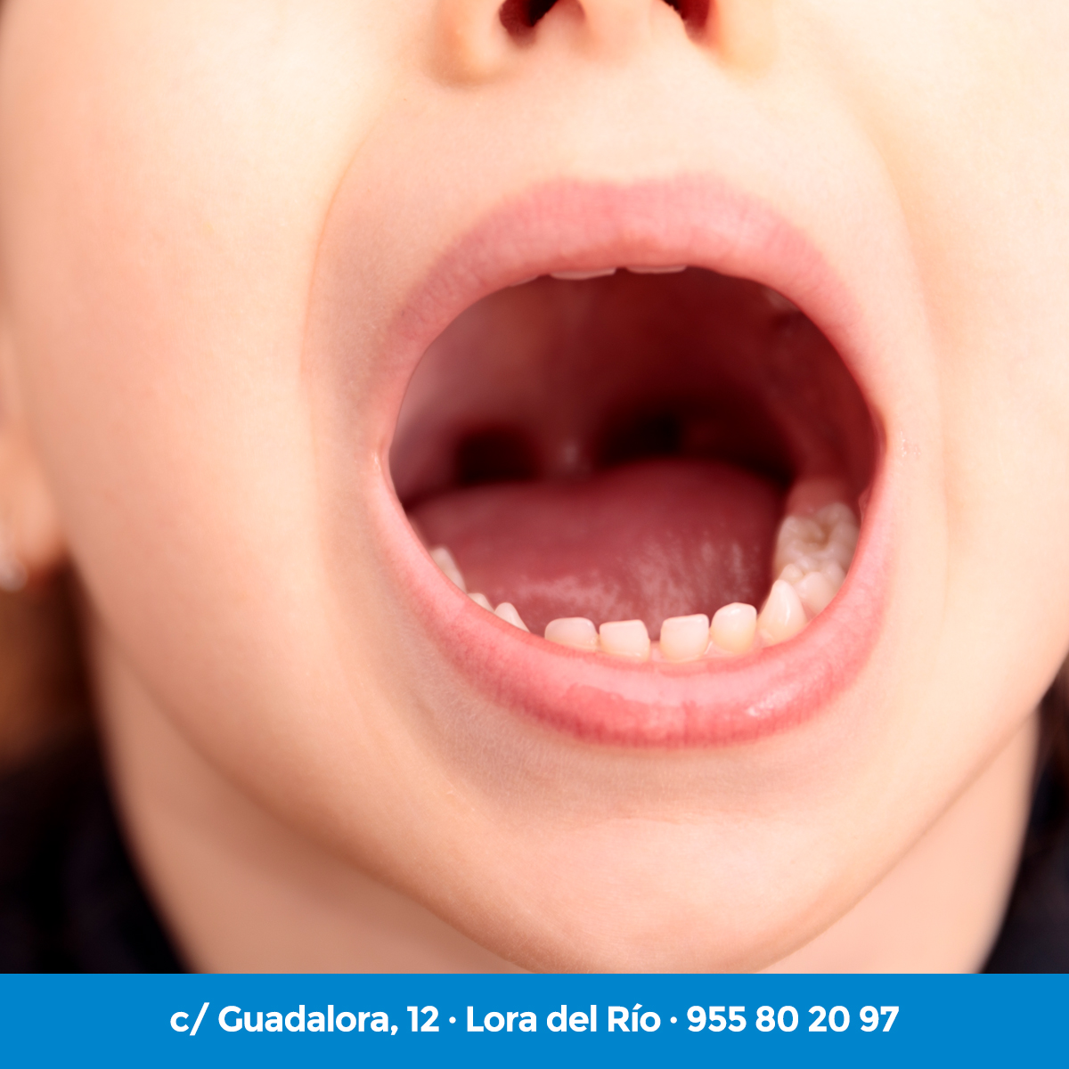 guadalora's tweet photo. ⚠️ ¡No dejes que los más pequeños de casa tengan caries! ¡Cuida de ellos, cuidando de sus dientes y de su alimentación!
📲 LLámanos y pide cita al 955 80 20 97
#dentistaguadalora #odontologoguadalora https://t.co/Z4lfSeGNnA