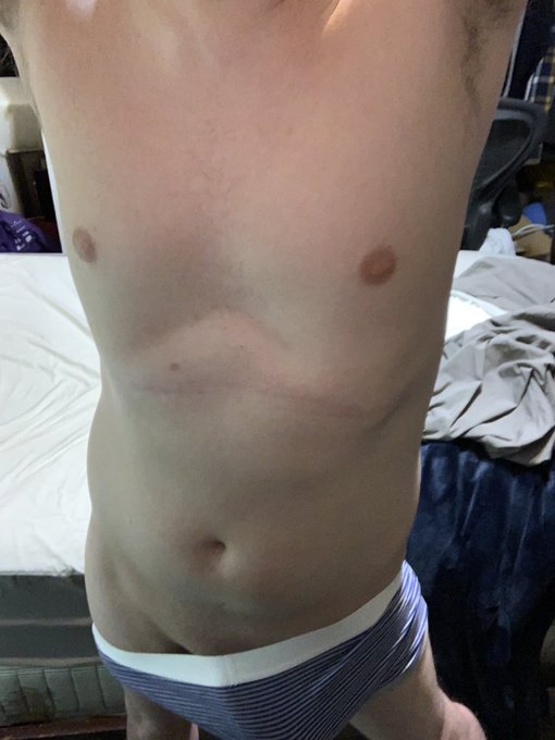 Hugo Balls XXX 🔞(email / DM To Book) - Feels Good to love yourself. #selfie https://t.co/sZSuLqfskb