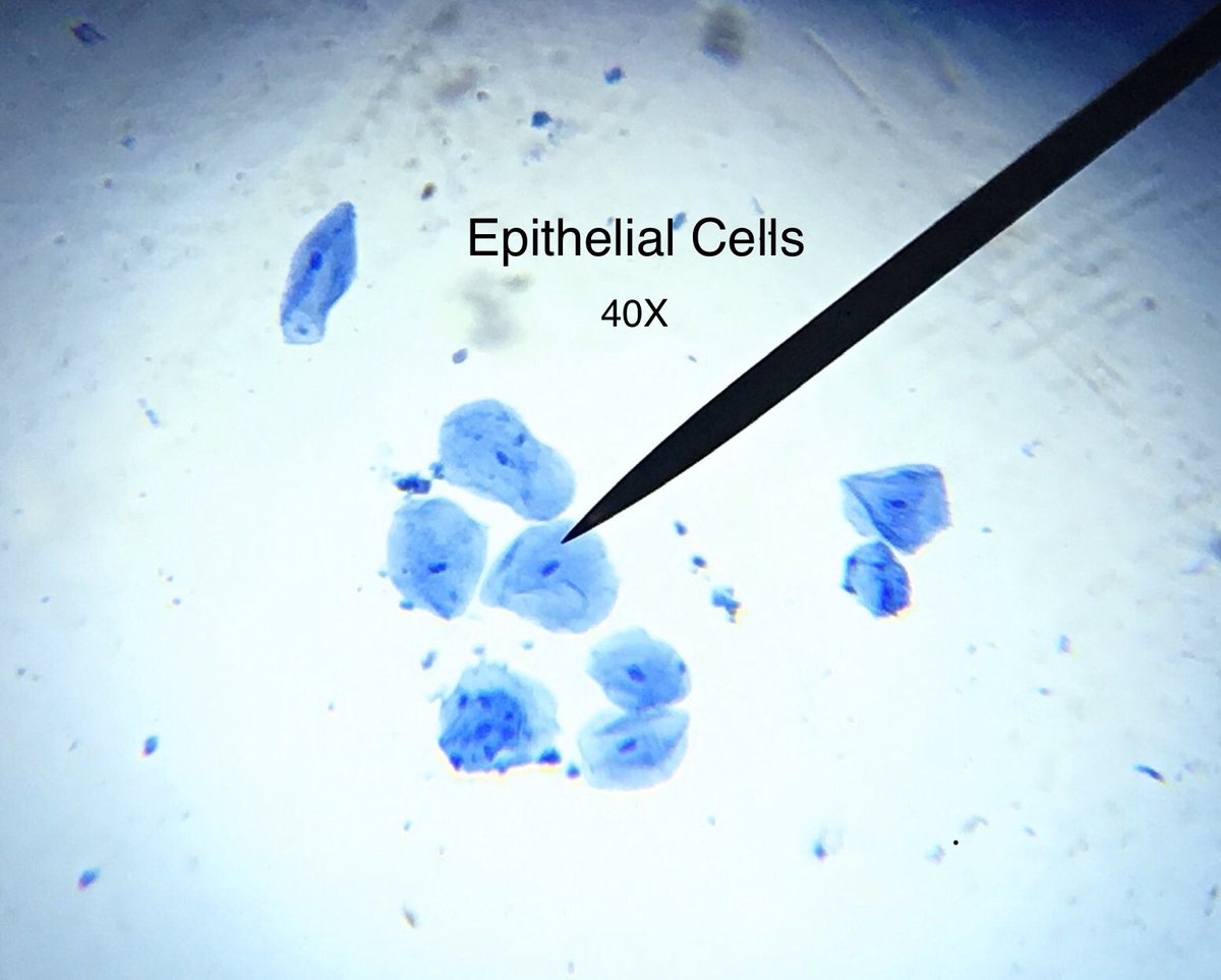 PepScienceSpot's tweet photo. Cell Lab run through to see possibile results before trying with students. Dark small dots inside blue dots=cell nucleus (from the inside of my cheek-yes I know it is gross!) Tiny bacteria appear as barely visible blue dots. #ephithelialcells #biology #SelectedTopicsinScience https://t.co/mwK7iIf7zH
